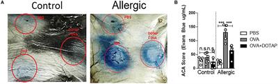 Allergen-Specific Immunotherapy With Liposome Containing CpG-ODN in Murine Model of Asthma Relies on MyD88 Signaling in Dendritic Cells